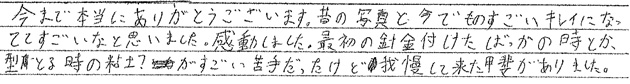 矯正治療を終えての感想